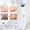 4-in-1 Facial Suction Blackhead Remover – Acne & Pore Cleaner | NovabyN