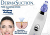 4-in-1 Facial Suction Blackhead Remover – Acne & Pore Cleaner | NovabyN